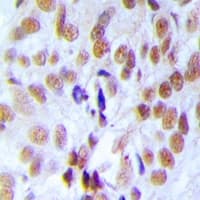 Polyclonal Rabbit anti-Human RFC4 Antibody (IHC, IF, WB)