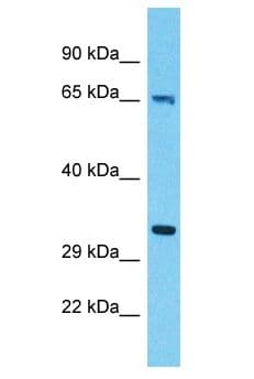 Polyclonal Rabbit anti-Human ALAS1 Antibody (aa46-95, WB)