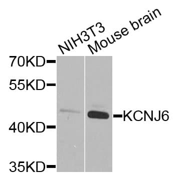 KCNJ6 / GIRK2 Antibody