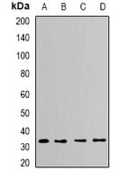 Polyclonal Rabbit anti-Human CAPZA2 / CAPZ Alpha 2 Antibody (IF, WB)