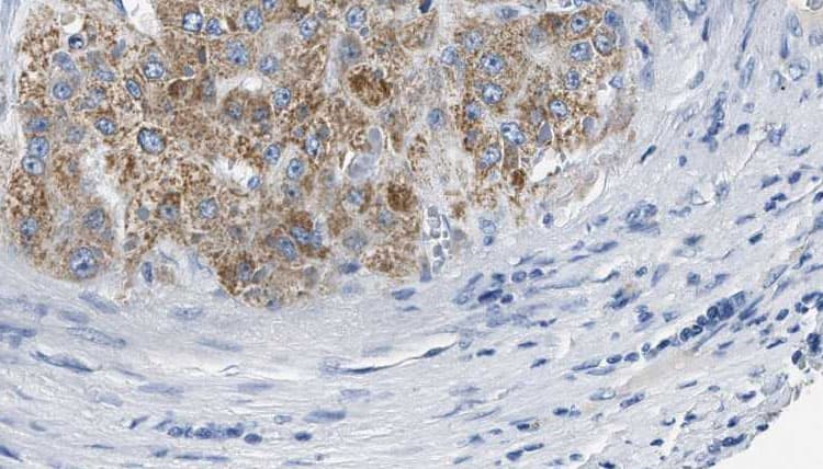 HTR2B / 5-HT2B Receptor Antibody