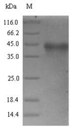 Rickettsia conorii RC0497 Protein (Recombinant 6His-SUMO, N-terminus)