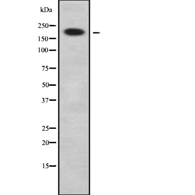 Polyclonal Rabbit anti-Human KIAA0833 / CAMTA1 Antibody (WB)
