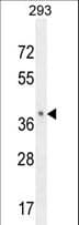 Polyclonal Rabbit anti-Human OR8B8 Antibody (aa280-308, IHC, WB)
