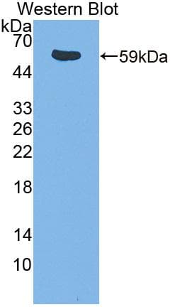 ITK / EMT Antibody (aa368-625)