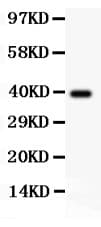 SIRT2 / Sirtuin 2 Antibody (aa165-187)