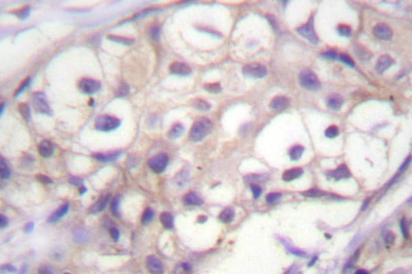 BRAF / B-Raf Antibody (Phe594)