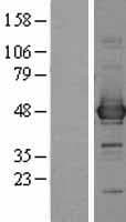 Human CCBL1 Protein (Over-Expression Lysate Myc-DDK (Flag))