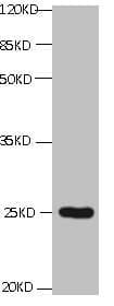 Monoclonal Mouse anti-Human CD59 Antibody (clone 2E11B6, IHC, WB)