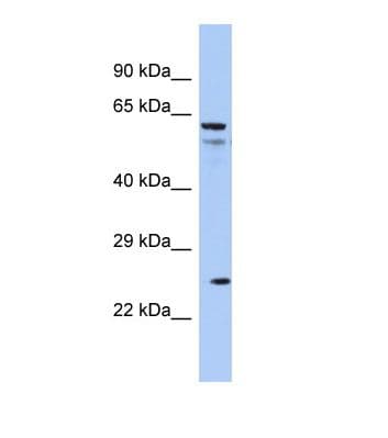 AQP5 / Aquaporin 5 Antibody (C-Terminus)