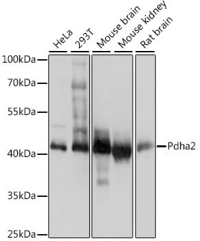 PDHA2 / PDH E1 Beta Antibody