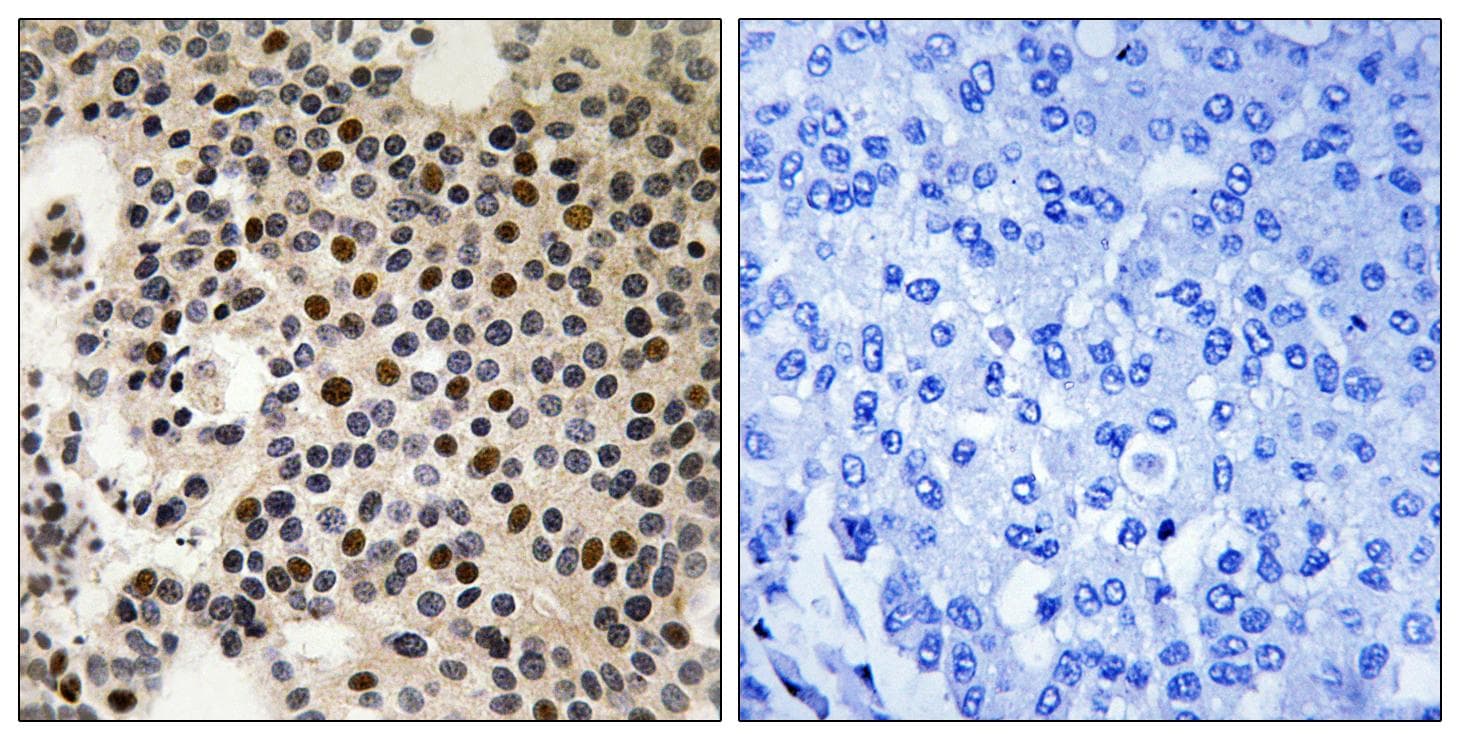 PAK2 Antibody (phospho-Ser197)