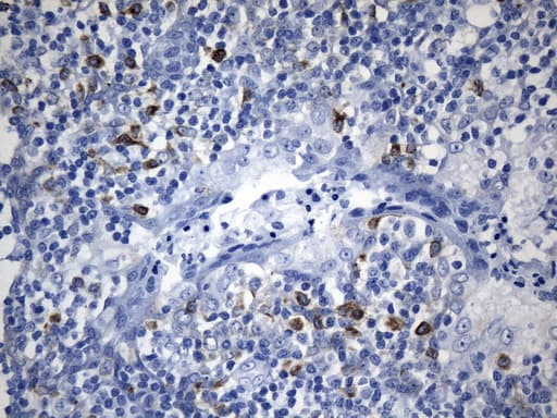 CTLA4 / CD152 Antibody (clone UMAB249, Carrier-free)