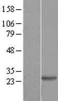 DIRAS2 Protein (Over-Expression Lysate Myc-DDK (Flag))