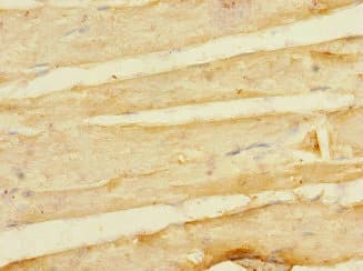LDB3 / ZASP Antibody