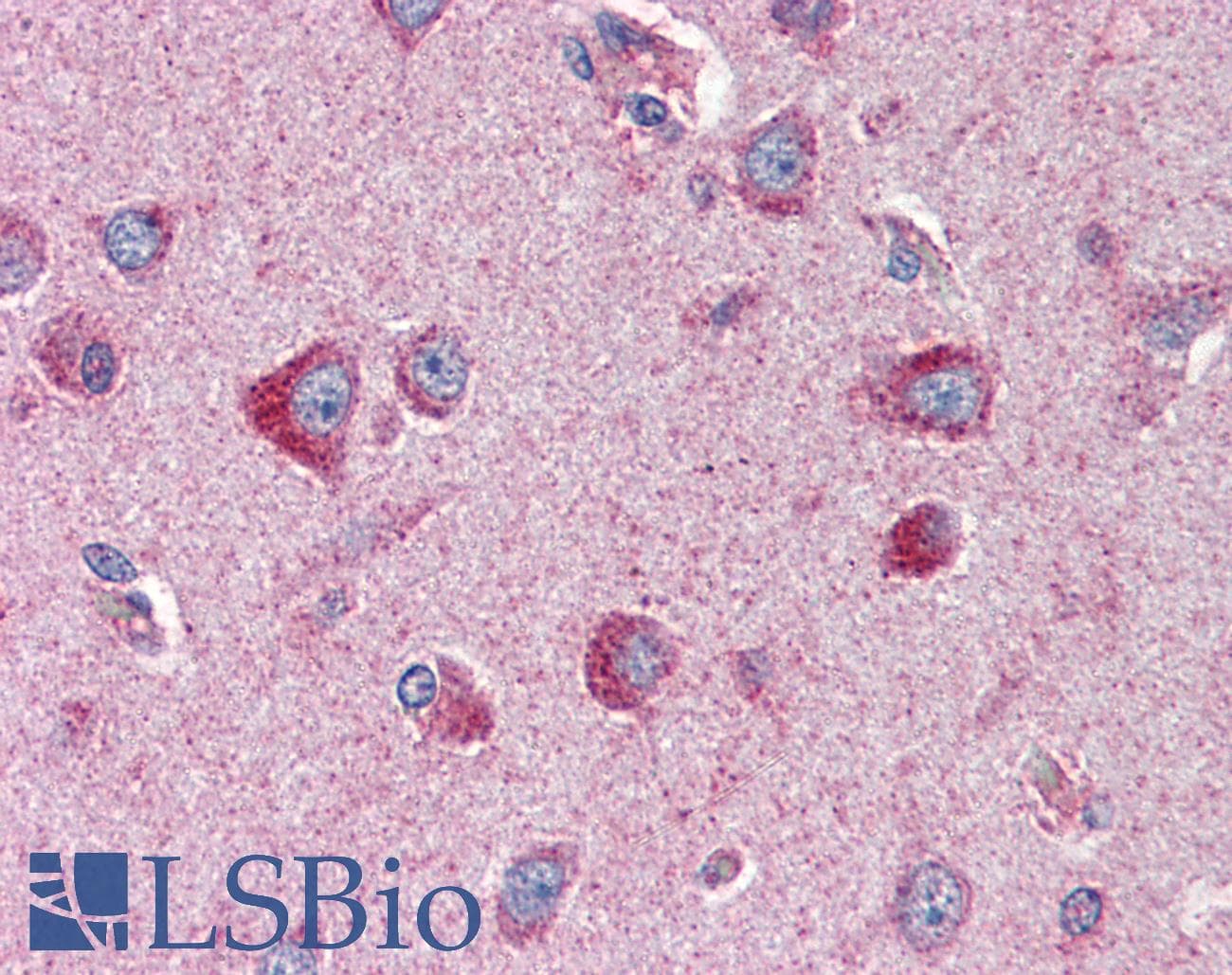 IHC-plus™ SLC22A17 Antibody (aa476-489)