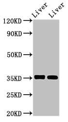 ASNS Antibody