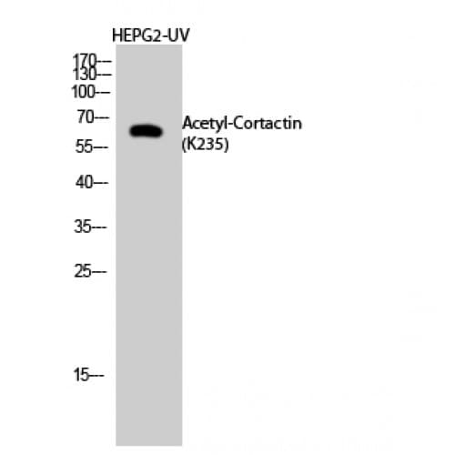 CTTN / Cortactin Antibody (Internal)