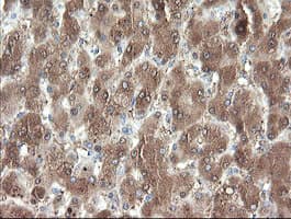 Monoclonal Mouse anti-Human PNPO Antibody (clone OTI1G9, IHC, WB)