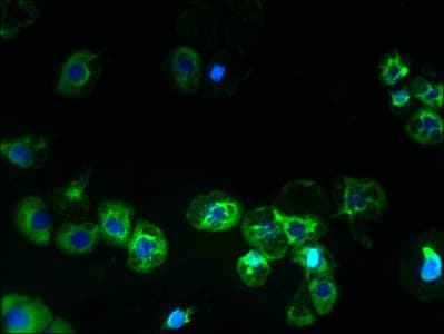 Polyclonal Rabbit anti-Human SLC38A2 / SNAT2 Antibody (aa1-76, IHC, WB)