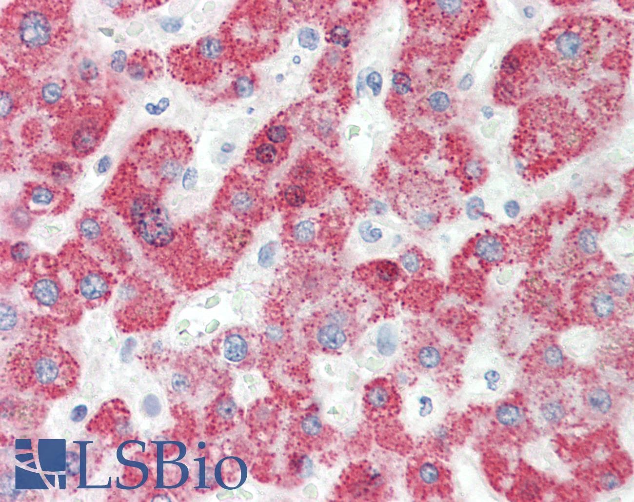 Polyclonal Rabbit anti-Human HMGCS2 / HMG-CoA Synthase 2 Antibody (aa51-100, IHC, WB)