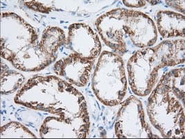 HIBCH Antibody (clone OTI3H5)
