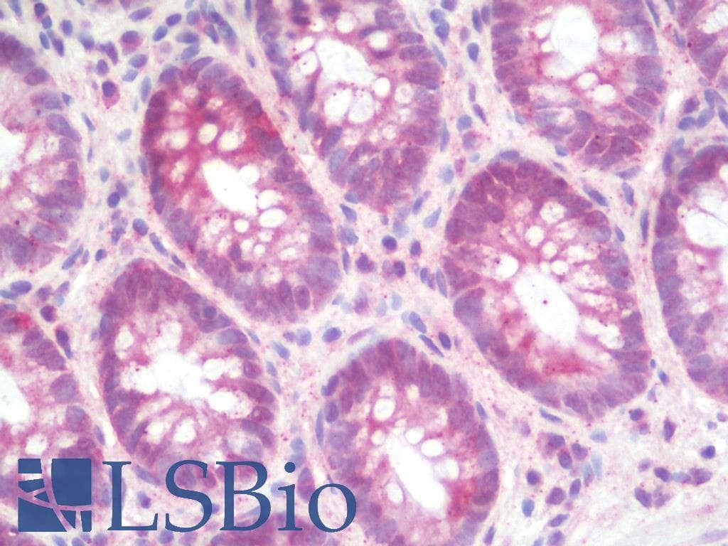 IHC-plus™ MTERF2 / MTERFD3 Antibody