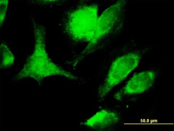 Monoclonal Mouse anti-Human FASLG / Fas Ligand Antibody (clone 2G9-G8, IF, WB)