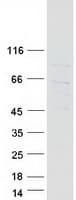 Human NOSTRIN Protein (Recombinant Myc-DDK (Flag))