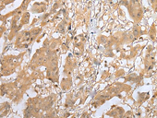 Polyclonal Rabbit anti-Human MOB4 / PHOCN Antibody (IHC, WB)
