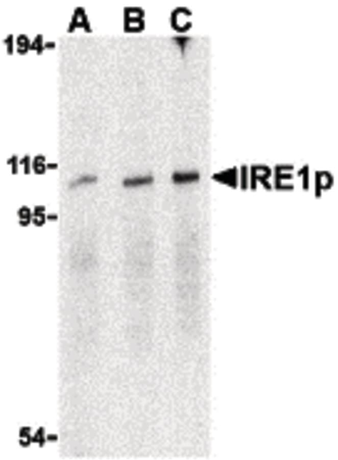 IHC-plus™ ERN1 / IRE1 Antibody