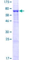 Human UGT3A1 Protein (Recombinant GST)