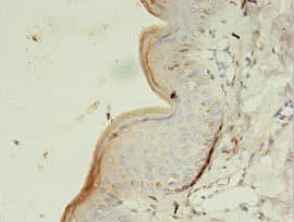 Polyclonal Rabbit anti-Human GK3 / Glycerol Kinase 3 Antibody (IHC, WB)