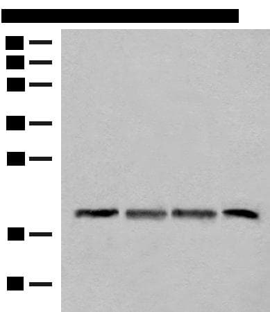SPC18 / SEC11A Antibody