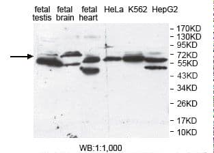 PLXDC2 Antibody (aa260-435)