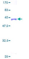 Human ARPC2 / p34-Arc Protein (Recombinant GST)