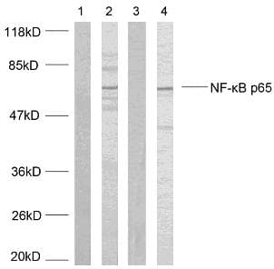 Polyclonal Rabbit anti-Human RELA / NFKB p65 Antibody (p468, IHC, WB)