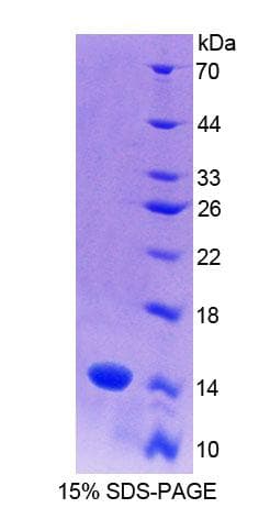 Rat S100A9 / MRP14 Protein (Recombinant His)