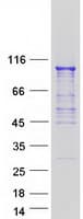 Human OS9 Protein (Recombinant Myc-DDK (Flag))