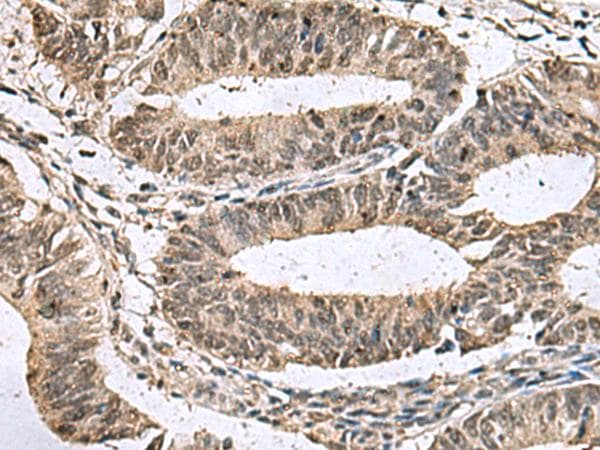 Polyclonal Rabbit anti-Human TMX3 Antibody (IHC)