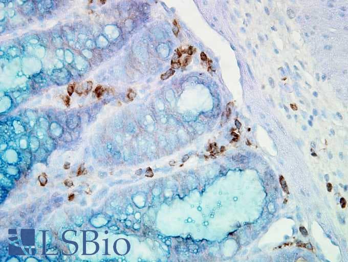 IHC-plus™ HSP90AA / HSP90 Alpha Antibody (clone Hyb-K41009)