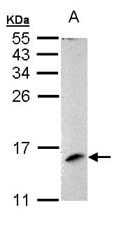 Polyclonal Rabbit anti-Human LAMTOR3 / MP1 Antibody (aa1-124, IHC, WB)