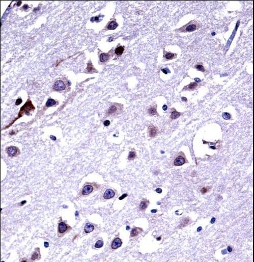 KIF16B Antibody (aa1-30)
