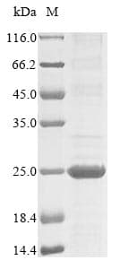Akkermansia muciniphila RuvC Protein (Recombinant 10His, N-terminus + Myc, C-terminus)