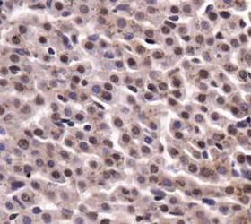 PKM / Pyruvate Kinase, Muscle Antibody (aa350-450)