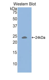 CD47 Antibody (aa18-219)