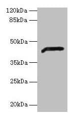 IHC-plus™ ADH7 Antibody