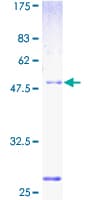 Human NUPL2 Protein (Recombinant GST)
