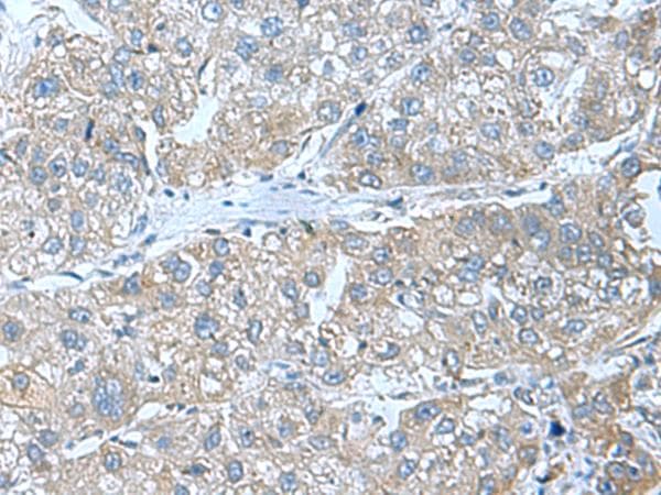 SRPK2 Antibody