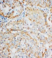 HSPD1 / HSP60 Antibody (Internal)
